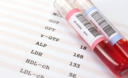 コレステロール　下げる